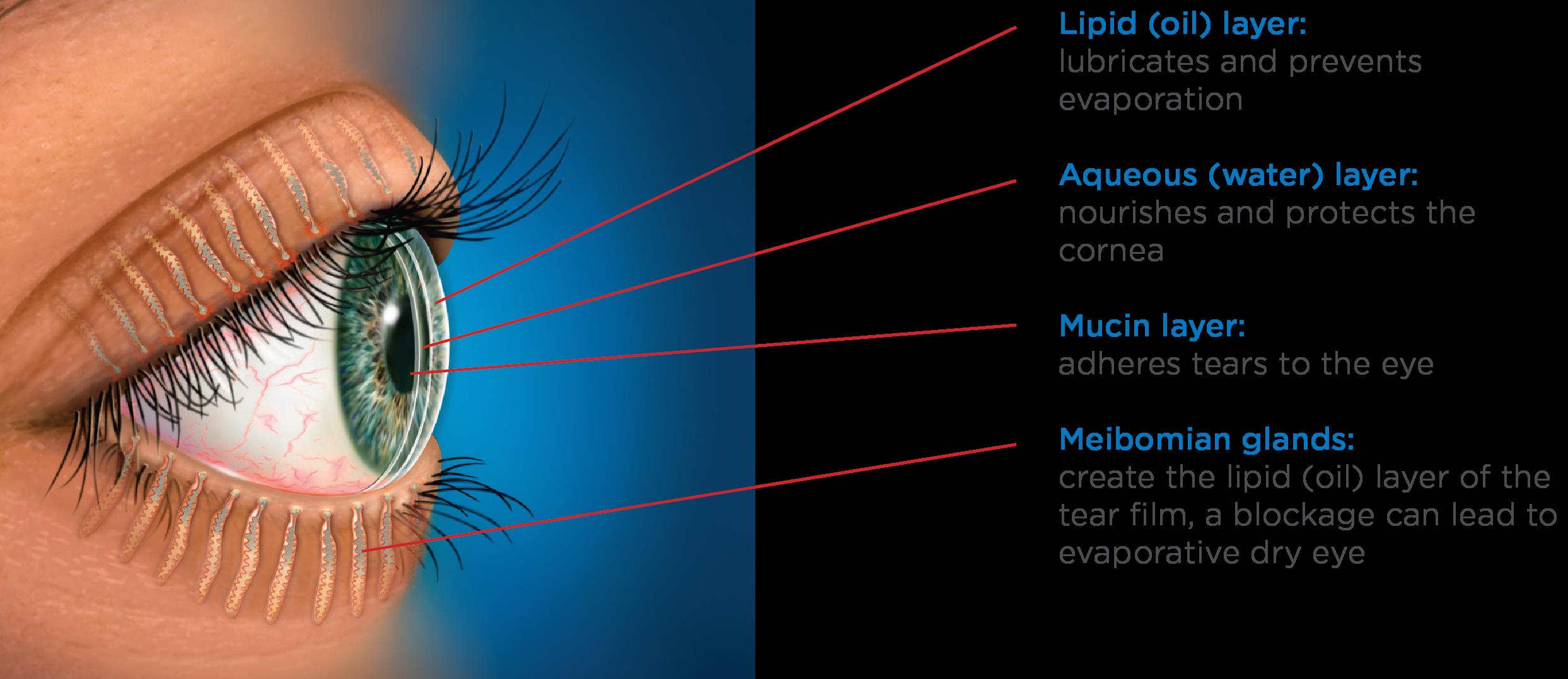 Meibomian Gland Expression Meibomian Gland Expression